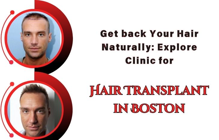 Get-back-Your-Hair-Naturally-Explore-Clinic-for-Hair-Transplant-in-Boston