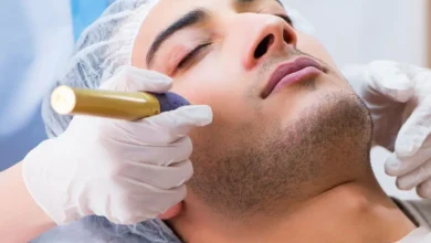 Laser Scar Removal in London: Effective Treatments for a Flawless Look