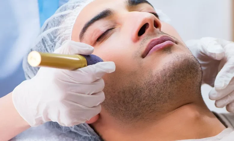 Laser Scar Removal in London: Effective Treatments for a Flawless Look