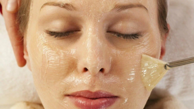 chemical peel treatment in Pakistan