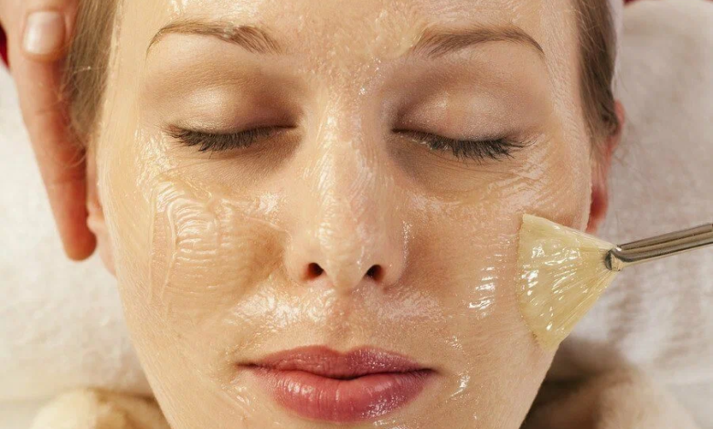 chemical peel treatment in Pakistan