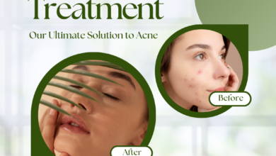 Is Permanent Acne Removal Possible? Here’s the Best Way