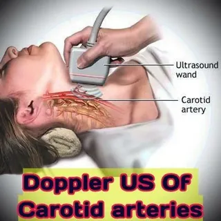 Doppler ultrasound near me