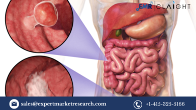 North America In-Vitro Colorectal Cancer Screening Tests Market