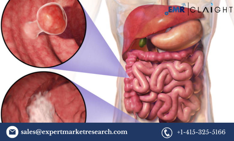 North America In-Vitro Colorectal Cancer Screening Tests Market