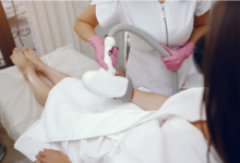 laser hair removal in Bristol