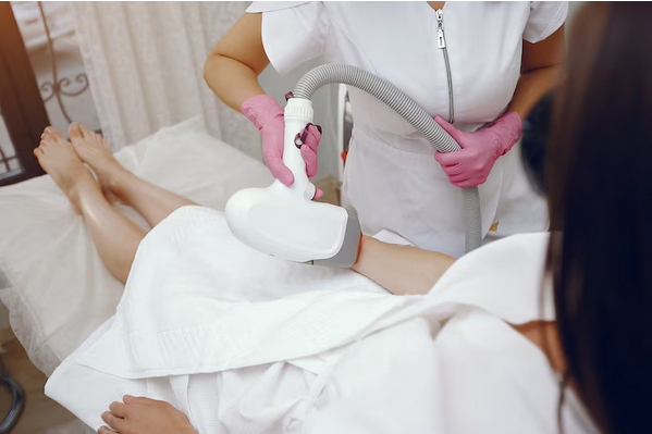 laser hair removal in Bristol