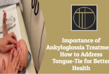 Ankyloglossia Treatment