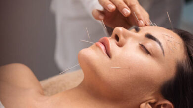 Acupuncture for Pain