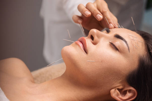 Acupuncture for Pain