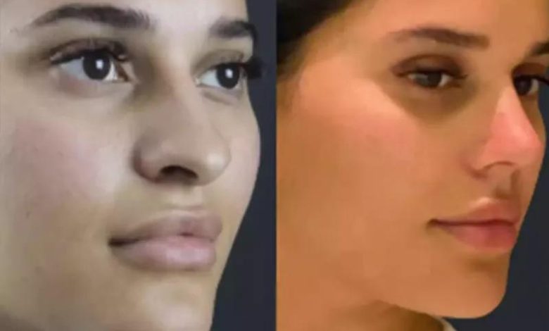 How to Find the Best Rhinoplasty Surgeon in Dubai for Perfect Results